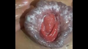Anal play prolapse gay