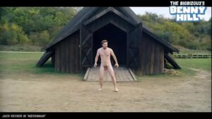 Vitiligo nude gay