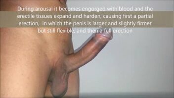 Gay colocou arame no canal do penis inflam ação